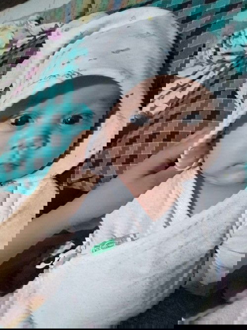 normal lang ba sa baby ang naduduling ?
 ano ano ang mga dapat gawin para hindi na sya maduling?