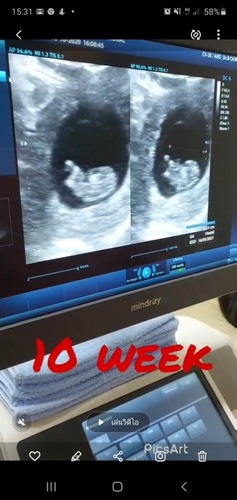 10 week แล้วนะ ดิ้นให้แม่เห็นด้วย