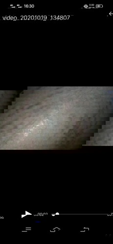 Bun ini garis garis merah d perut bisa hilang pake apa yah