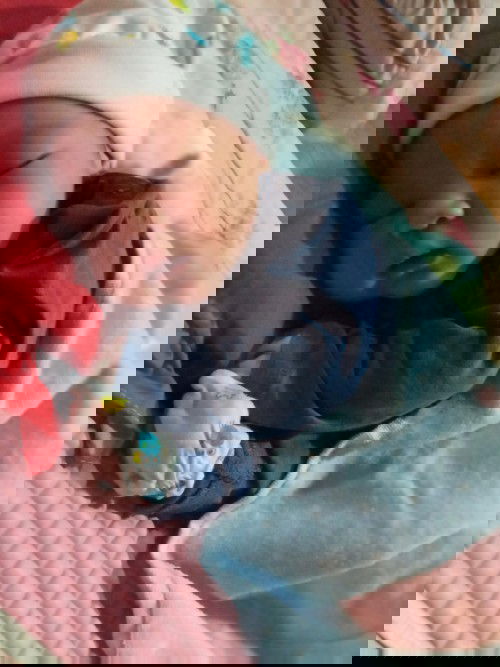 คลอดไม่ออกต้องผ่า