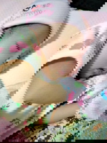 ผ่าคลอดตอนนี้นเองได้ 10 วันแล้วค่ะ