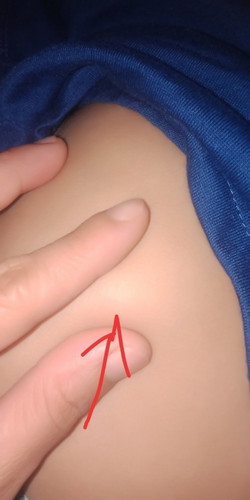 hai po good evening po sa lahat..tanong q lng po kung normal lng po ba ang my bukol sa bandang ribs po