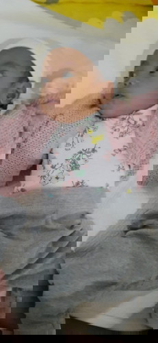 Underweight at 4months