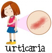 Skin Allergy Test (Urticaria)