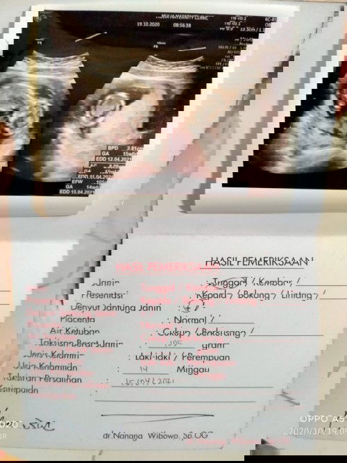 Ada yang samaan kaya aku HPL April 2021 ???