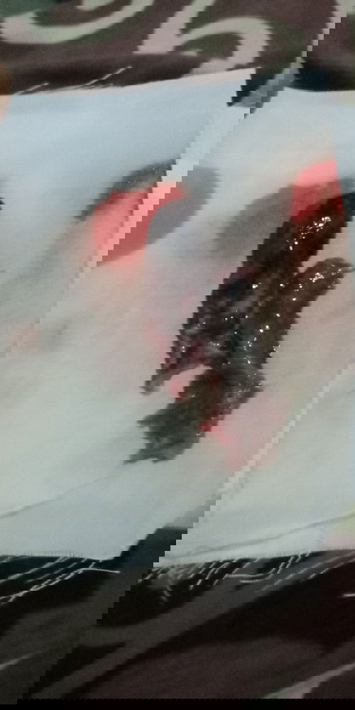 Hamil 7minggu keguguran