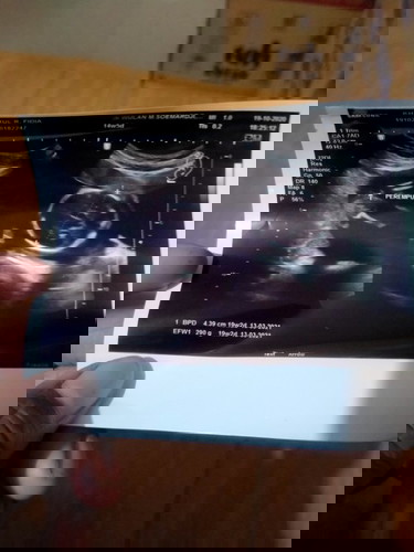 Cara mbaca hasil usg