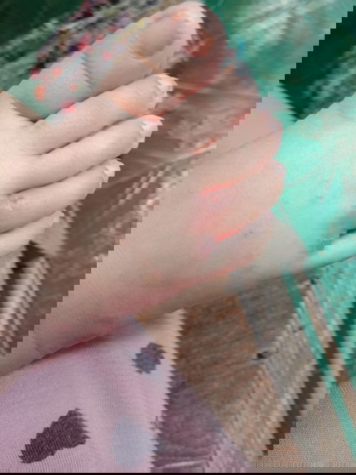 Gatal atau cacar air?