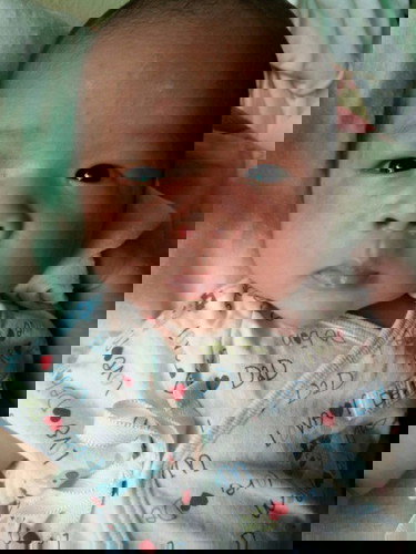 ตุ่มขึ้นหน้า มีสาเหตุอะไรบ้างคะแม่ๆ