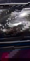 Masih awam.. Tolong pencerahannya bunda.