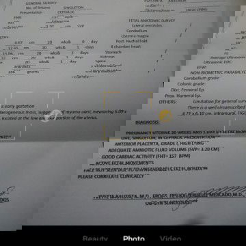 Myoma during 20weeks and 2days of pregnancy