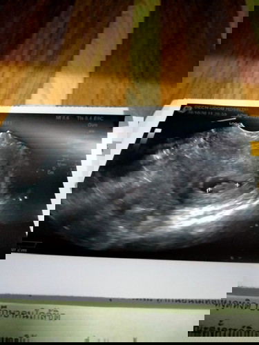 ใครเป็นไหมคะ