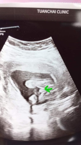 อิแม่อยากได้ลูกสาวค่ะ