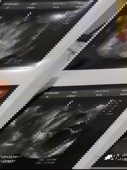 Mohon saran nya ya bun