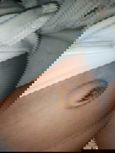 Navel
