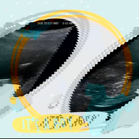 34 weeks & 2 days...