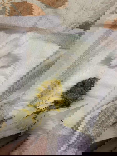Normal poops ba? 10days old. Mixed Feed. S26 gold & BMilm