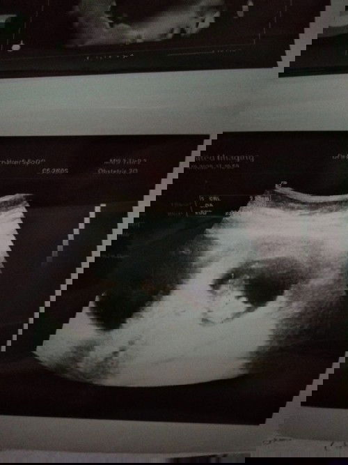 Usg pertma di week 9