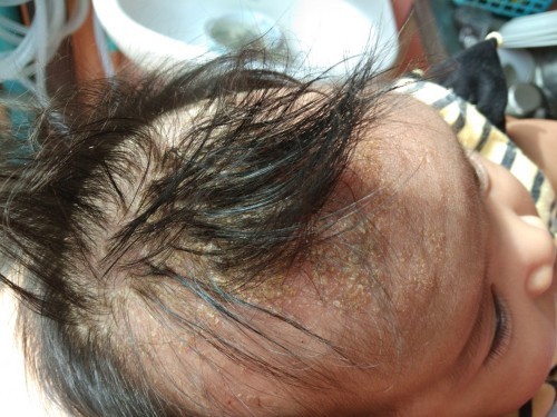 ปรึกษาเรื่องอาการที่เกิดกับเด็กวัยทารก