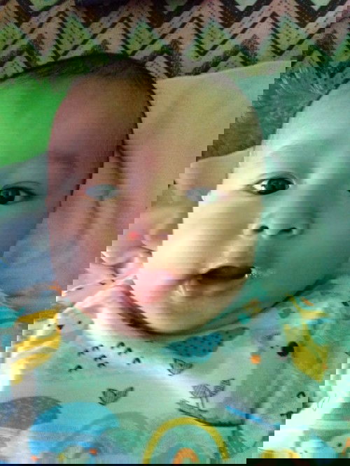 Tanda lahir yg berubah