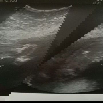 เพศชายหรือเพศหญิงค่ะ