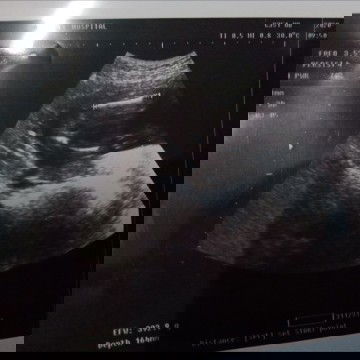 ตั้งครรภ์ .