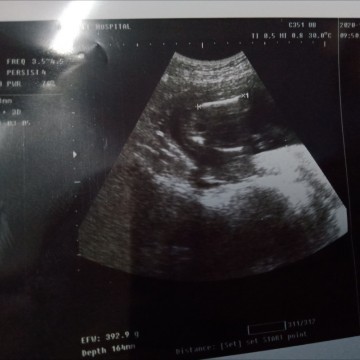 ตั้งครรภ์ .