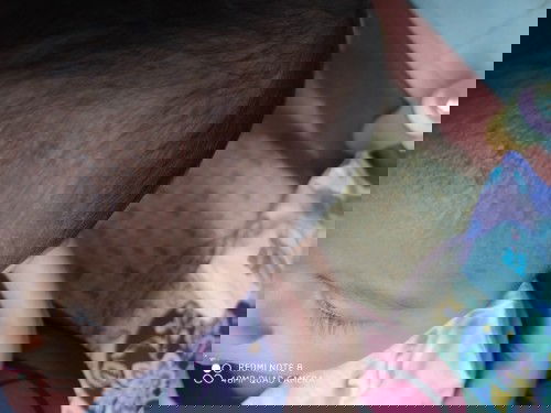 bruntusan keringat buntet