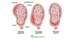 placenta Privia
