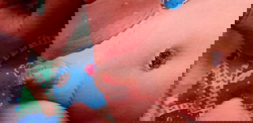 จู๋น้องมีหนอง. 😢😢