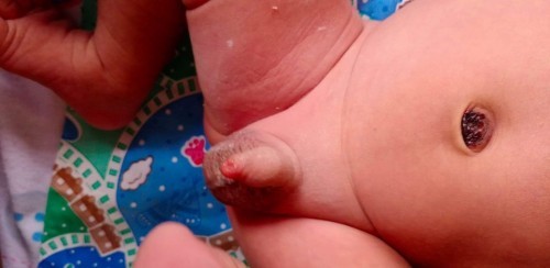 จู๋น้องมีหนอง. 😢😢