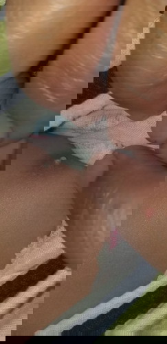 Puting bayi berjerawat