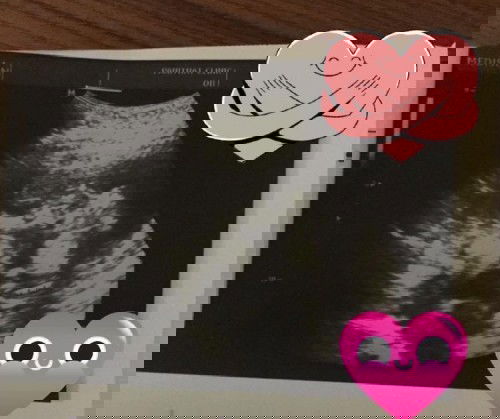 มีแม่ท่านไหนเป็นแบบเราบ้างมั้ย