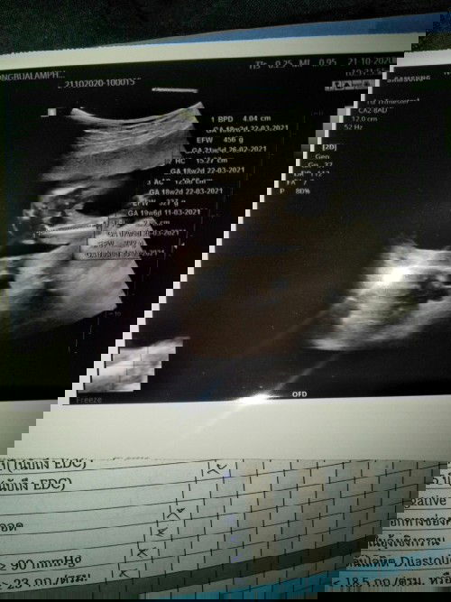 17+6วีคหรือ18+2