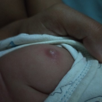 แบบนี้ปกติมั้ยคะ