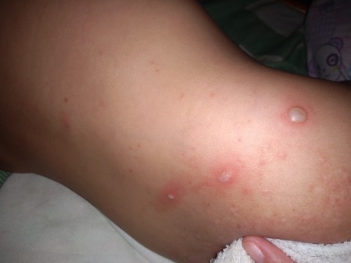 Need your answers ☹️ sana may pumansin nito badly needed you :(