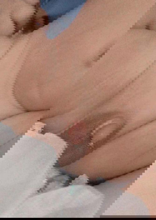 Sunat bayi kapan sembuhnya ? Ga kasian?