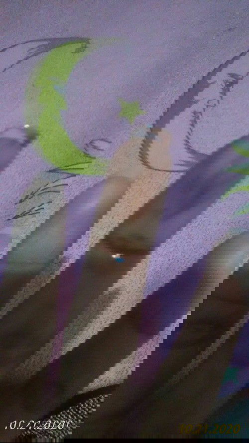 Keluar flek coklat smcam lagi haid tpi gak bau darah.. kira" itu gejala normal apa gmna ya... info n