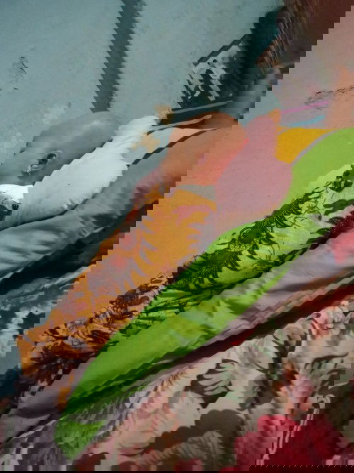 Bentuk kepala normal atau tidak