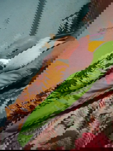 Bentuk kepala normal atau tidak