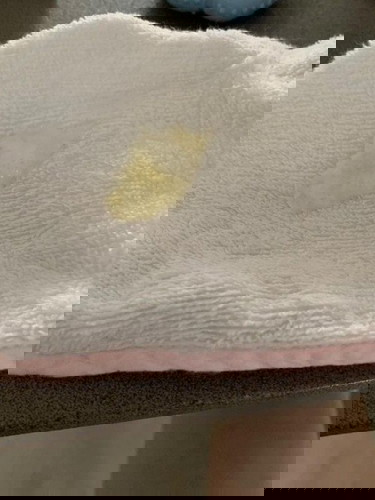 Does breastmilk causes phlegm, LO is 4m old