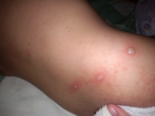 Need your answers ☹️ sana may pumansin nito badly needed you :(