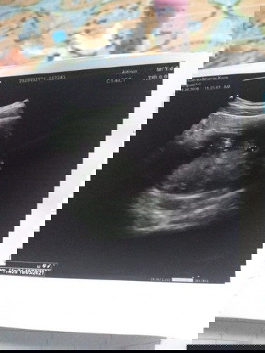 ช่วยดูหน่อยค่ะ