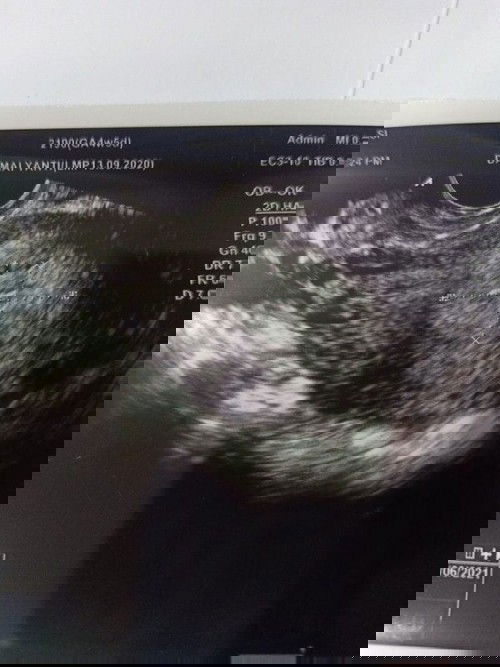 Lanjutan cerita yang kemarin tanggal 16okt setelah 3 bulan lalu nifas, pas di testpack hasilnya pstf