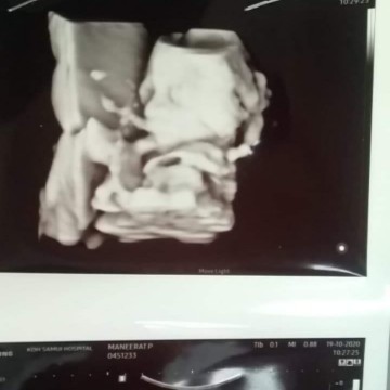 19Week3day