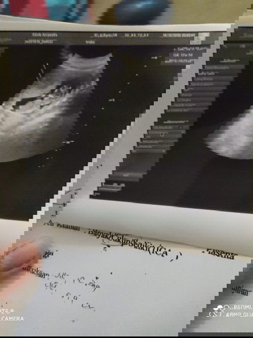 Sharing tempat bersalin yang paling nyaman di bekasi dong bun...