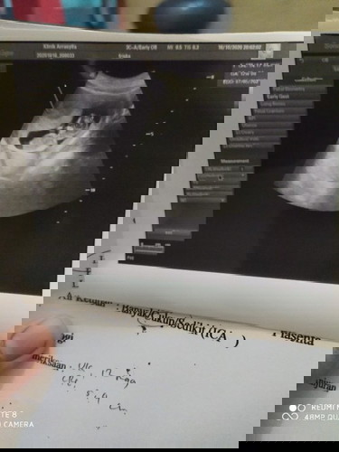 Sharing tempat bersalin yang paling nyaman di bekasi dong bun...