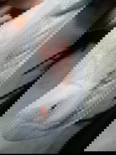 Bleeding at 10 weeks