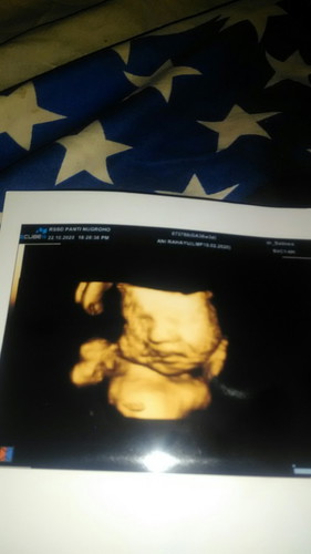 Tolong dong solusinya biar ke.posisi normal bun