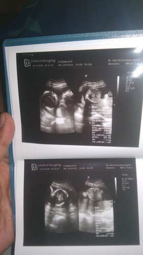 Antara seneng dan sedih